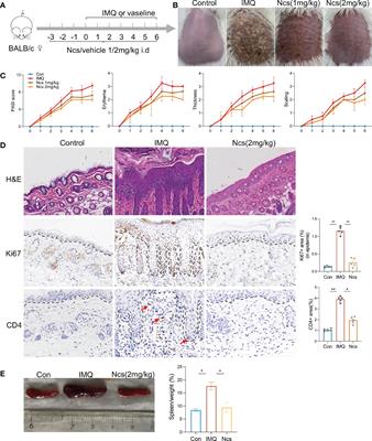 Narciclasine inhibits phospholipase A2 and regulates phospholipid metabolism to ameliorate psoriasis-like dermatitis